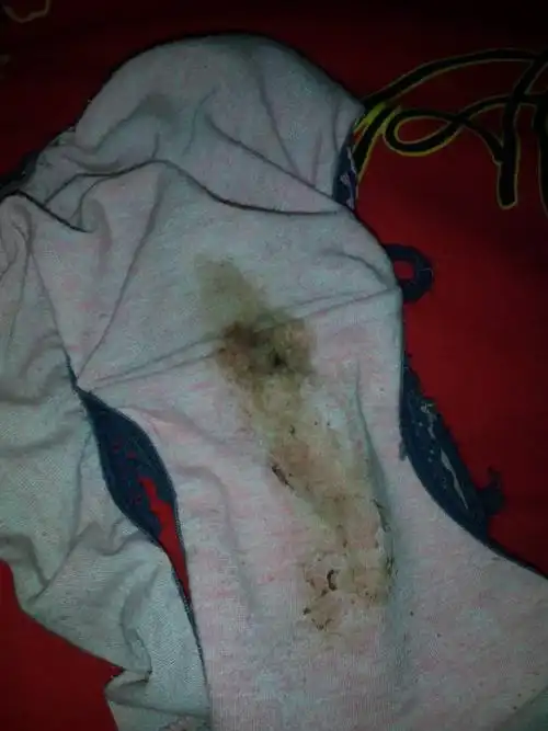 第一次内裤上出现这种情况,是不是见红了?