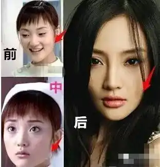 从不正面回应别再说李小璐整容了现在的她真的美的精致