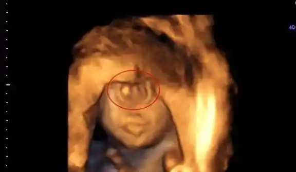 "都怪我"宝妈怀孕看b超以为是双胞胎,孩子出生宝妈后悔_医生_女士