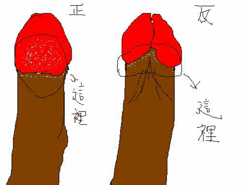 龟头红点脱皮怎么回事