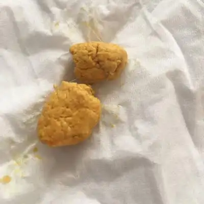 一周大的婴儿拉的屎是硬块,是怎麼回事啊?