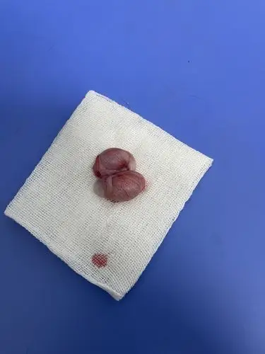 【讨论】那个……想看看大家崽崽绝育割下来的蛋蛋图片(有蛋蛋图慎入)