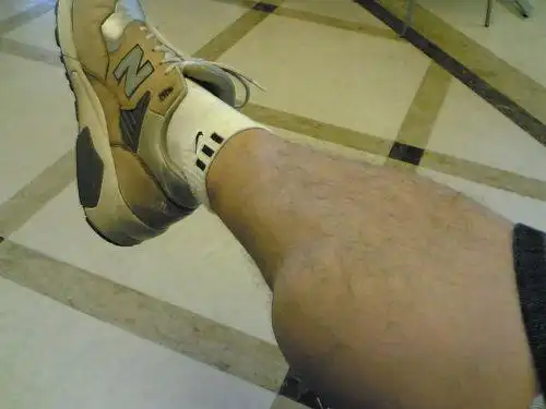 小腿肌(小腿肌肉拉伤最好的治疗方法)