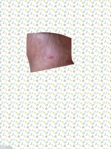 一个大豆豆里有好多小豆豆,像透明的,是什么?