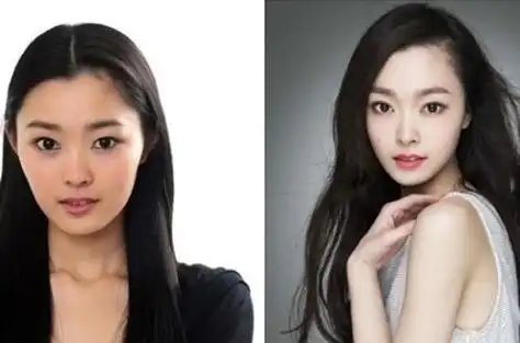 宋轶个人资料简介宋轶是否整容过