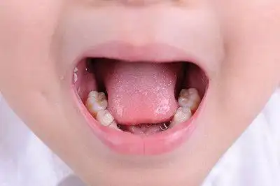 原来!舌苔厚白的6个最快消除方法"春色满园"-第1张图片-酷虎博客