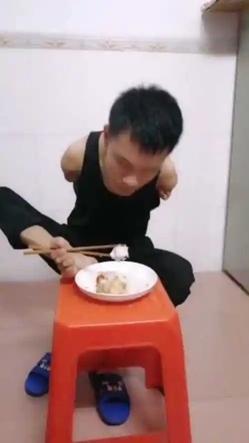 残疾小伙用脚吃饭看这艰难模样活着就是痛苦