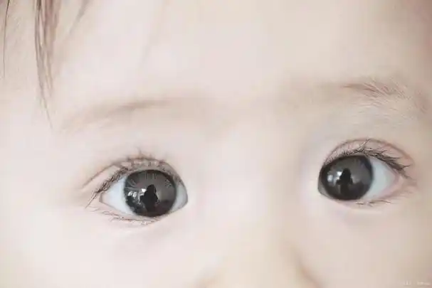 宝宝最近总是揉眼睛是怎么回事?