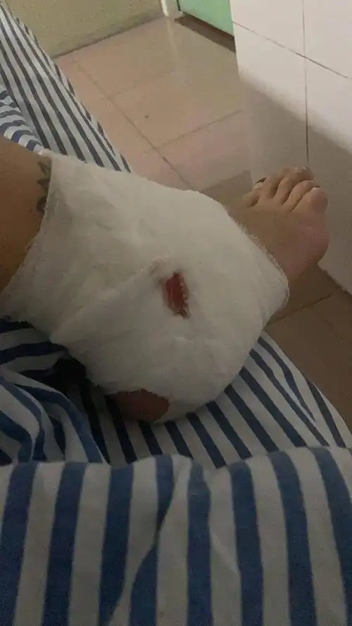 深夜飙车市民发帖凌晨时分在步行街竟被撞伤