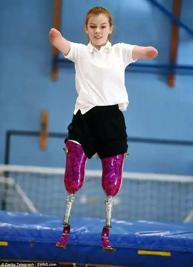 少女7岁时被截去四肢,却让自己成为了全国跳床冠军和美妆博主!