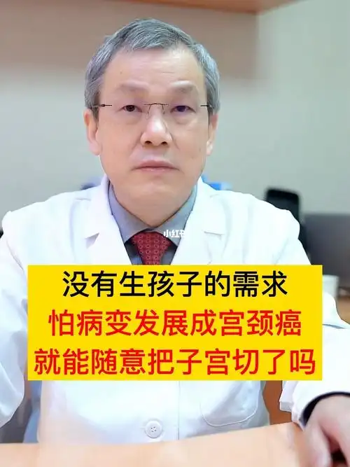 子宫可以随便切除吗