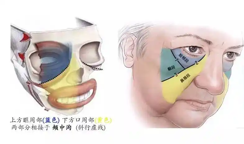 汇合在面颊中部由颧弓韧带向皮肤延伸而形成的斜行边界,称为颊中沟