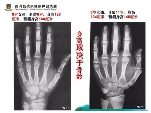 别把孩子催熟了|家庭教育|骨龄|初潮|李喆_网易订阅