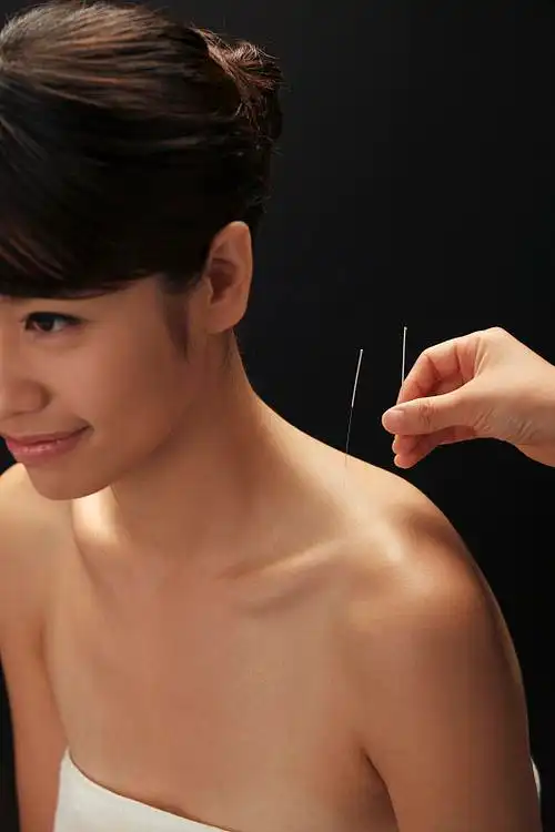 中医针灸