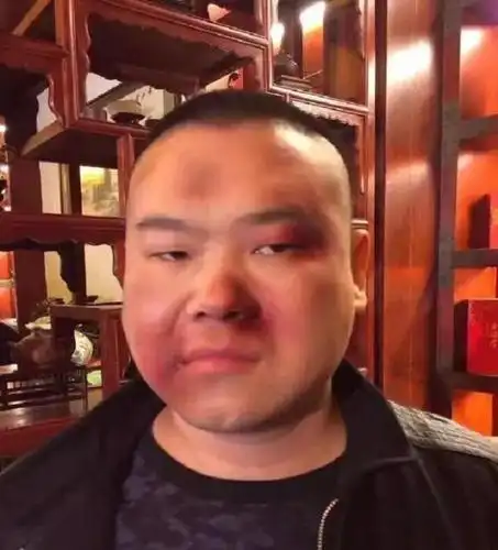 岳云鹏夜市吃饭被店家殴打, 当郭德纲找上门后, 气的大骂: 真活该