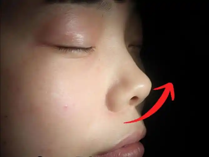 朝天鼻,露鼻孔,短鼻,调整思路