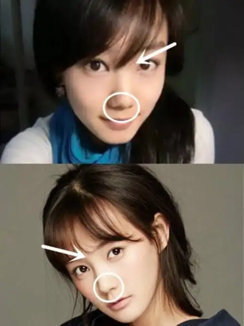 永远的女主李一桐,"整容史"比后台还精彩 李一桐的_圈子-新氧美容整形