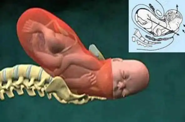 组图还原顺产分娩全过程越往后看越心疼女人真的是经历了81难