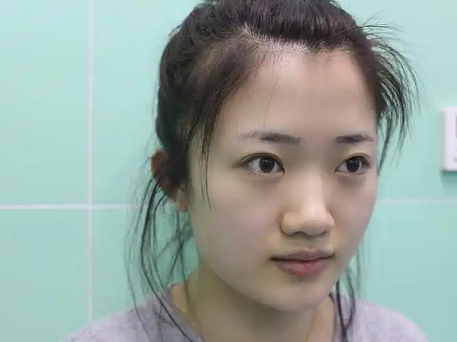 很庆杏眼双眼皮图片杏眼双眼皮女生杏眼双眼皮图片杏眼双眼皮手术