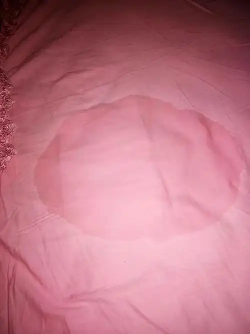 小肚子有一阵小疼,不敢确定是不是要生了,不知道是不是羊水破了2018年