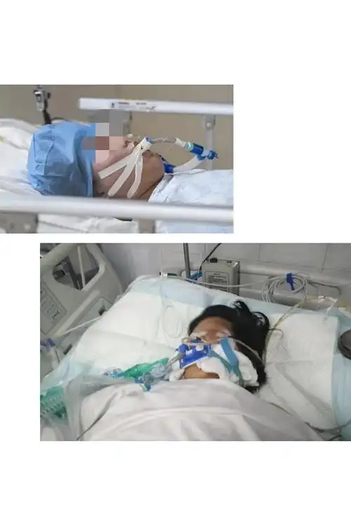 气管插管,心肺复苏,呼吸机的使用 是每一位医护人员都必须熟练掌握的