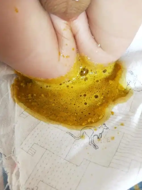 宝宝拉的臭臭 | 妈妈网轻聊_千万女人的共同选择