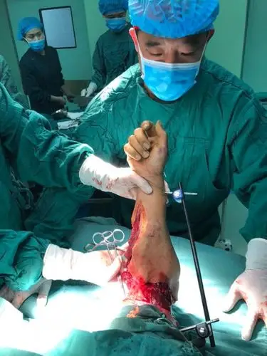 争分夺秒抢救断臂——创伤新高度