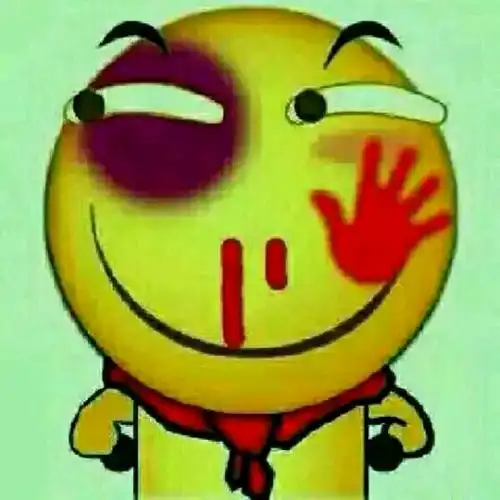 恶搞鼻青脸肿受伤坏笑gif动图_动态图_表情包下载_soogif