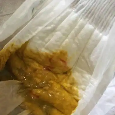 我女儿今天刚好九个月,今天大便里有点血要紧吗,平时有点拉肚子的.