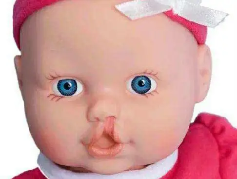 原创孩子一出生兔唇,孕妈谎称吃过兔肉,医生一句话说出了真相!