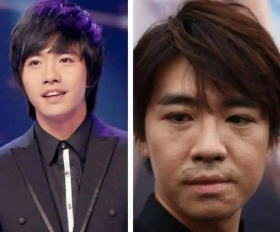 俞灏明刚从韩国整容回来吗32岁帅成端木磊网友终于等到你