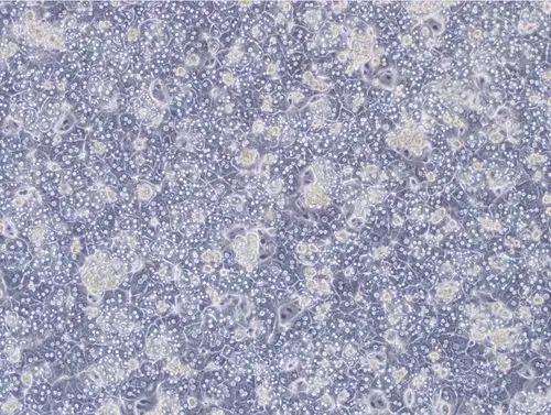 最后贴一下国外大神分离的原代小鼠肝细胞图片.