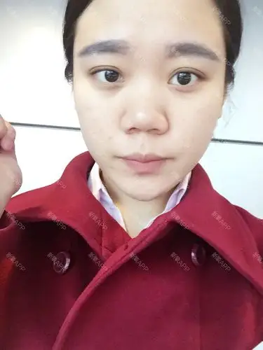 1,标题【上海余天成"打造网红"代言人】 救救我的塌鼻子