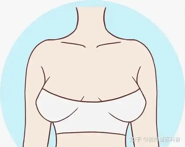 胸部外扩的原因是什么?如何矫正扩胸?_千颜网