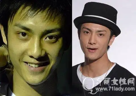 姜潮整容前后对比照片姜潮麦迪娜在一起了吗