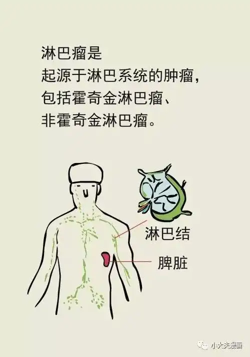 脖子上长肿块就是淋巴瘤吗?