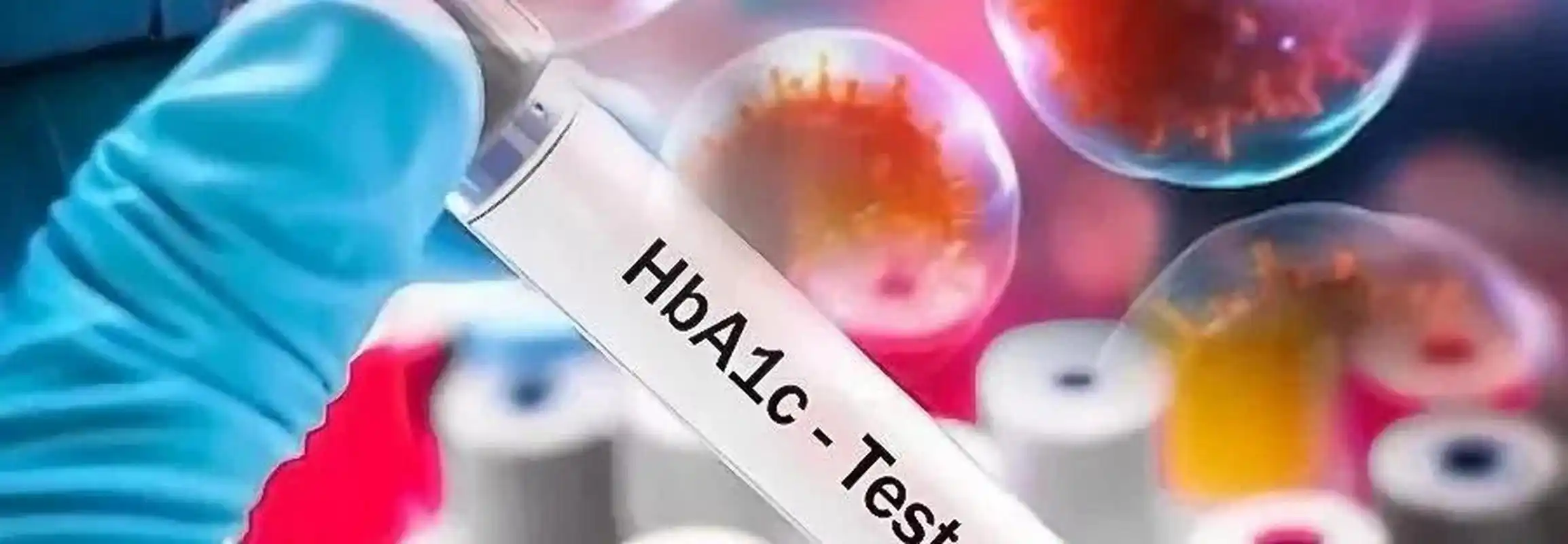 5%,这是不是可以确诊糖尿病? 确实,当糖化血红蛋白水平超过6.