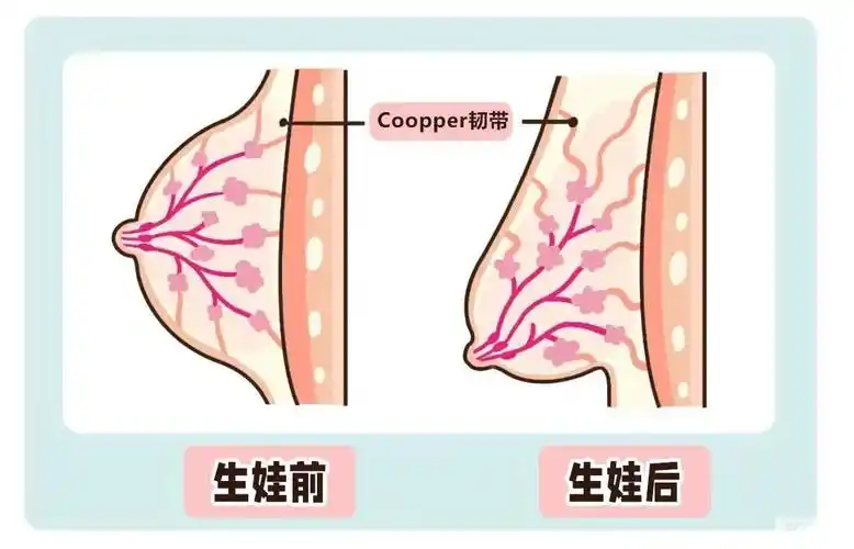 知名女星哭诉孕期"胸下垂",想胸部挺拔饱满该怎么破? 图片-5