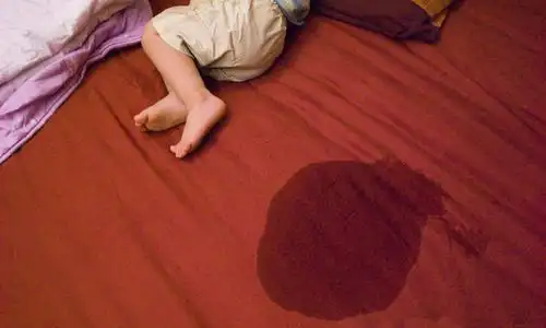 导致儿童尿床的原因是有哪些