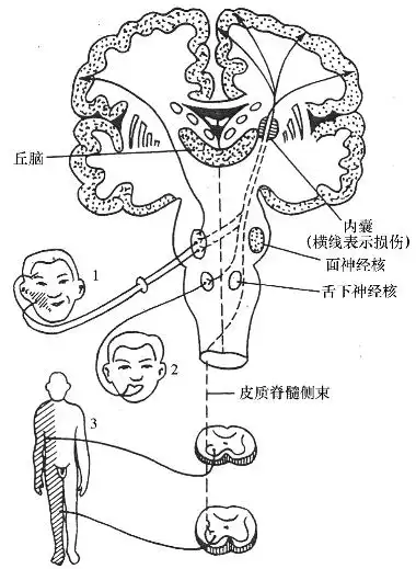 运动系统病变定位诊断