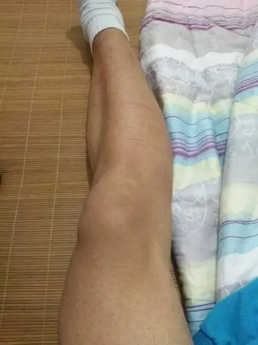 大腿肌肉为什么用力会收缩