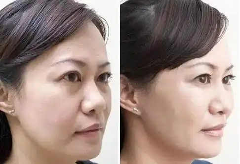 看女明星10年前后对比照!跑赢衰老你也有戏!