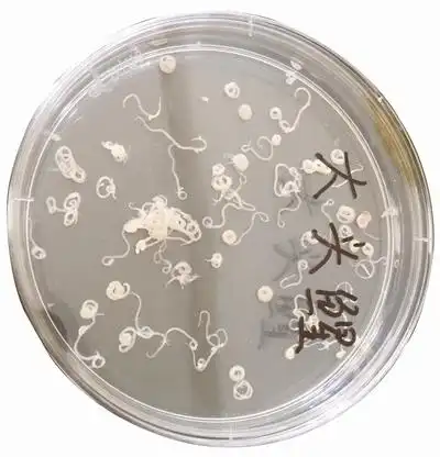 异尖线虫 赵 波 摄