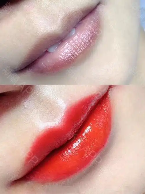 氧气zyraj半永久纹唇第0天美丽日记