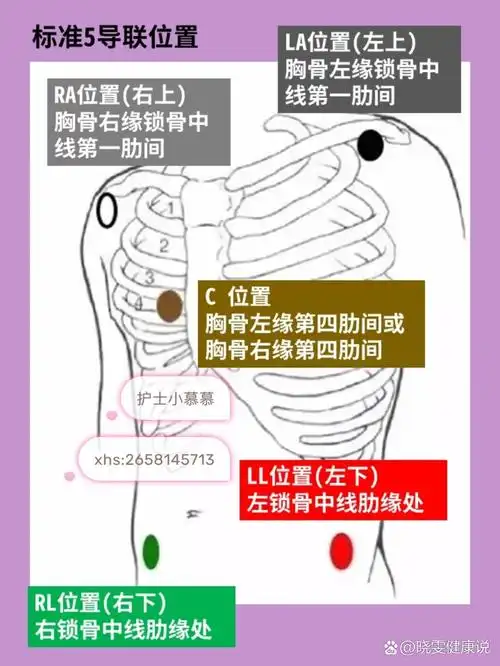 护士,教你看懂心电监护仪,超简单