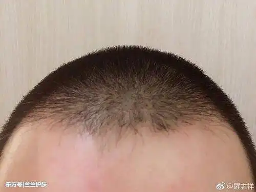 罗志祥深夜发平头发型照点赞数破万粉丝一定是骗人的