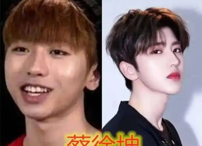 8位改头换命的男明星王一博脸已僵硬刘恺威眼皮才是灵魂