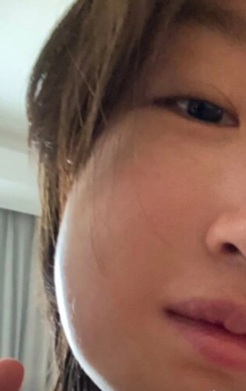 周冬雨整容后脸肿到认不出?微博可怜巴巴求助网友,称只是拔了智齿