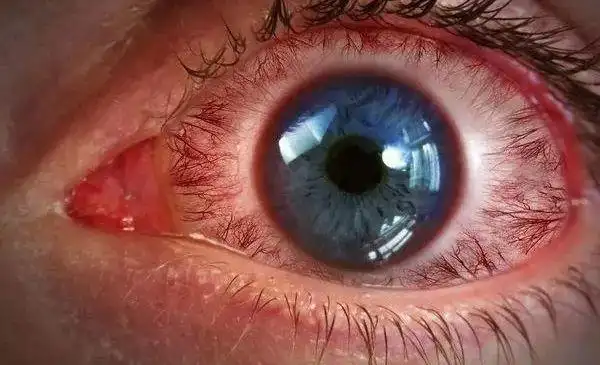 阻隔蓝光保护眼睛还能调节睡眠改善肤质近视和散光人士也可以量身定制