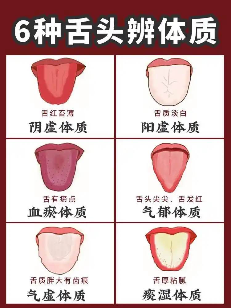 中医讲究看舌象:6种体质看舌头或能分辨,快测测你是哪种体质?